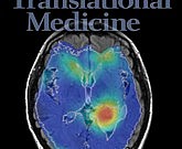 NMR-image-of-brain-glioma