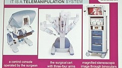 da Vinci surgery system